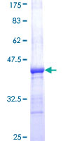 12.5% SDS-PAGE Stained with Coomassie Blue.